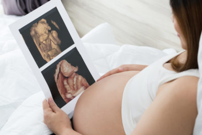 In sozialen Medien bewerben viele Schwangere Ultraschallgeräte zur Anwendung zuhause. Doch dieses "Babykino" kann dem Fötus schaden, warnen Frauenärzte.
