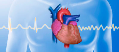Hinter dem Symptom "Herzrasen" kann sich manches verbergen: Eine funktionelle Sinustachykardie, ein Vorhofflimmern, eine paroxysmale supraventrikuläre oder eine ventrikuläre Tachykardie. Deshalb ist eine EKG-Dokumentation zwingend erforderlich.