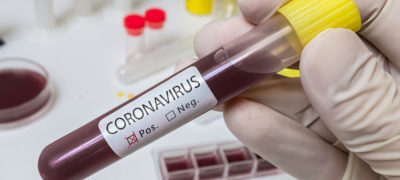 Mit der Ausbreitung des Coronavirus Sars-CoV-2 ist ein Wettbewerb zwischen Biotech-Unternehmen und Forschungsinstituten weltweit entbrannt. Wer stellt als Erstes einen wirksamen Impfstoff her?